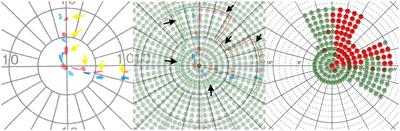 Placebo effect after visual restitution training: no eye-tracking controlled perimetric improvement after visual border stimulation in late subacute and chronic visual field defects after stroke